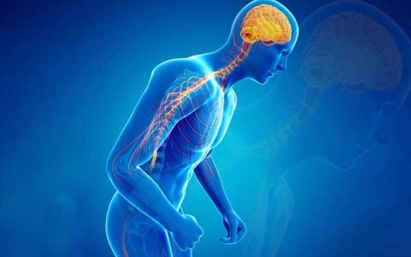 বিশ্বজুৰি প্ৰায় ১ কোটি ১৭ লাখ লোক পাৰ্কিনছন ৰোগত ভুগিছে ! আচলতে পাৰ্কিনছন কি, এই ৰোগৰ কাৰণ কি ?